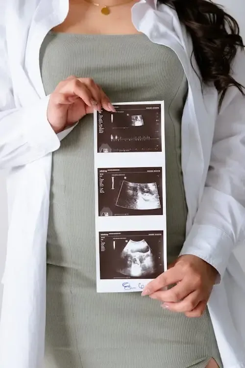 image of expecting mother holding up ultrasound image sheet